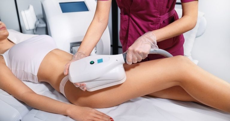 Will CoolSculpting Help Me Lose Weight?
